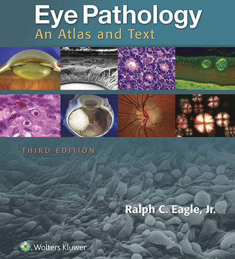 Cover image for book Eye Pathology