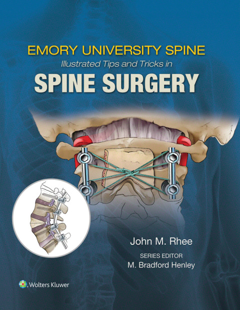 Cover image for book Emory's Illustrated Tips and Tricks in Spine Surgery