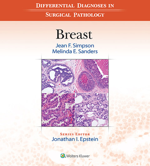 Cover image for book Differential Diagnoses in Surgical Pathology: Breast