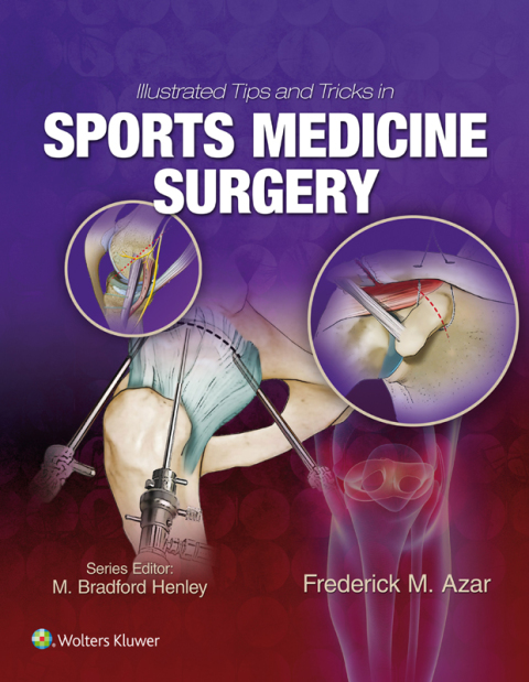 Cover image for book Illustrated Tips and Tricks in Sports Medicine Surgery