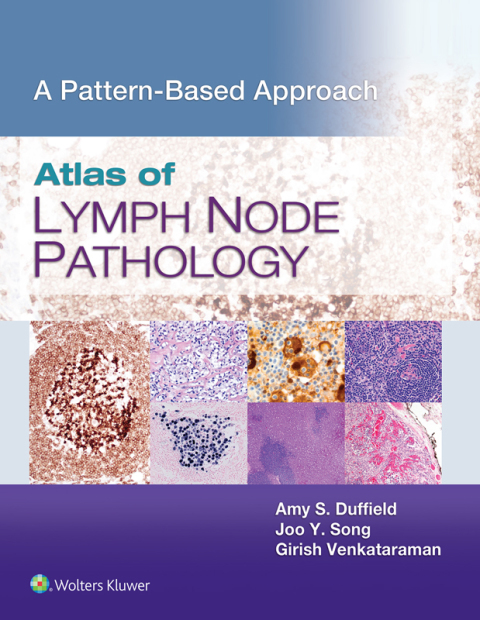 Cover image for book Atlas of Lymph Node Pathology
