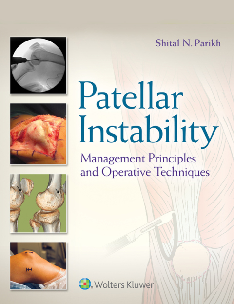 Cover image for book Patellar Instability