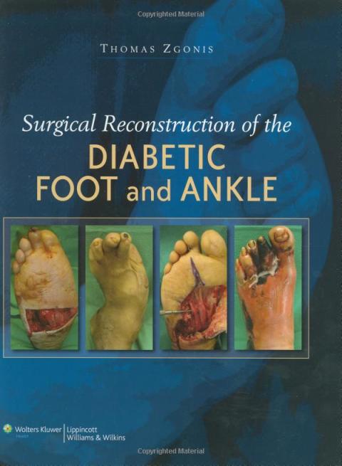 Cover image for book Surgical Reconstruction of the Diabetic Foot and Ankle