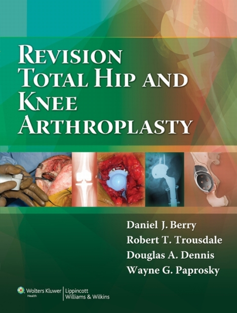 Cover image for book Revision Total Hip and Knee Arthroplasty