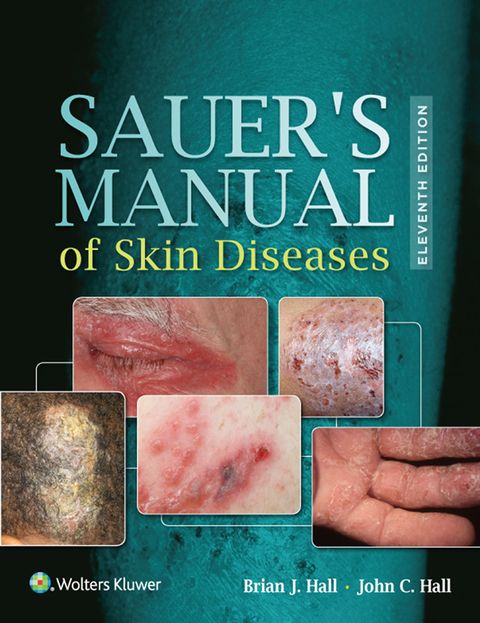 Cover image for book Sauer's Manual of Skin Diseases