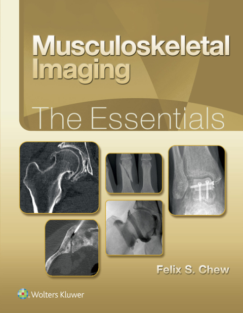 Cover image for book Musculoskeletal Imaging: The Essentials