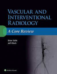 صورة الغلاف: Vascular and Interventional Radiology: A Core Review 9781496384393