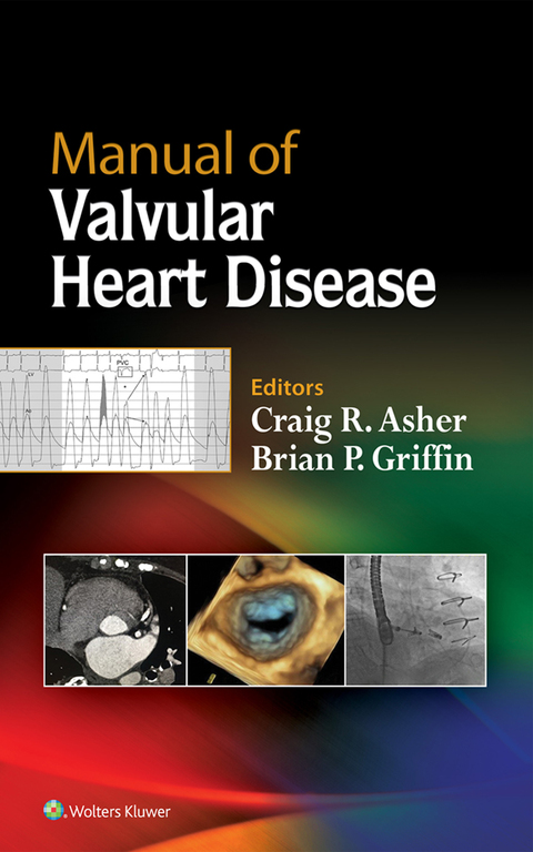 Cover image for book Manual of Valvular Heart Disease