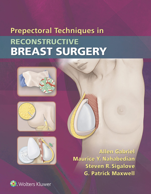 Cover image for book Prepectoral Techniques in Reconstructive Breast Surgery