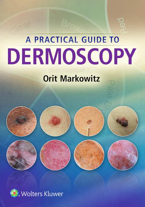 Cover image for book A Practical Guide to Dermoscopy