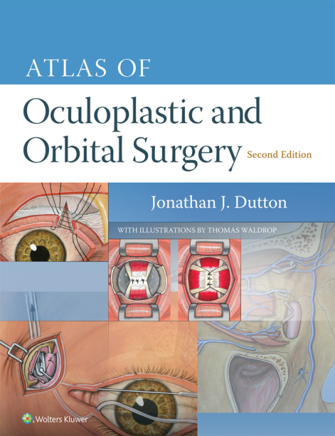 Cover image for book Atlas of Oculoplastic and Orbital Surgery