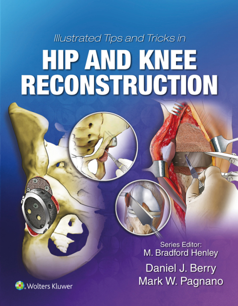 Cover image for book Illustrated Tips and Tricks in Hip and Knee Reconstructive and Replacement Surgery