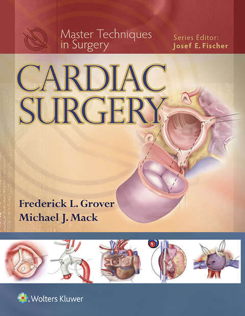 Cover image for book Master Techniques in Surgery: Cardiac Surgery