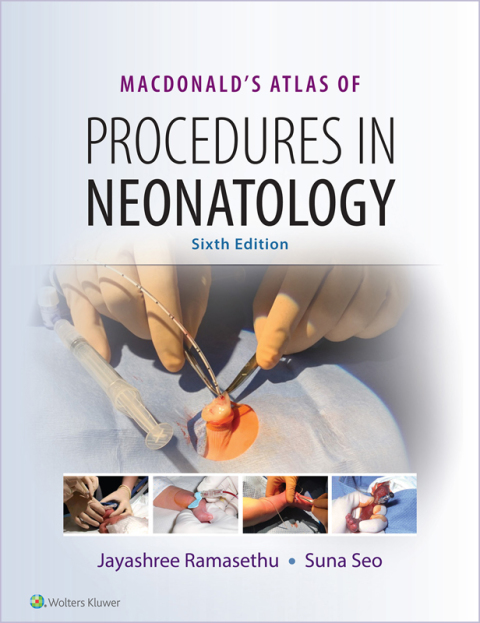 Cover image for book MacDonald's Atlas of Procedures in Neonatology