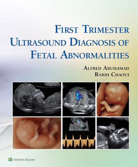Cover image for book First Trimester Ultrasound Diagnosis of Fetal Abnormalities