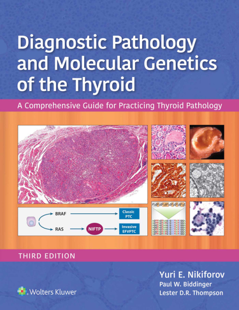 Cover image for book Diagnostic Pathology and Molecular Genetics of the Thyroid