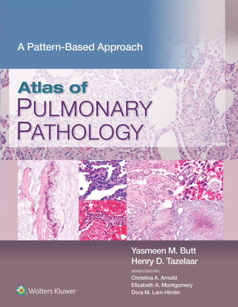 Cover image for book Atlas of Pulmonary Pathology