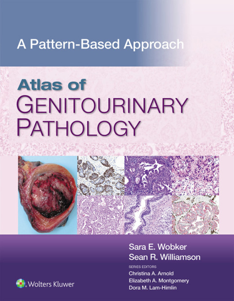 Cover image for book Atlas of Genitourinary Pathology