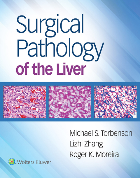 Cover image for book Surgical Pathology of the Liver