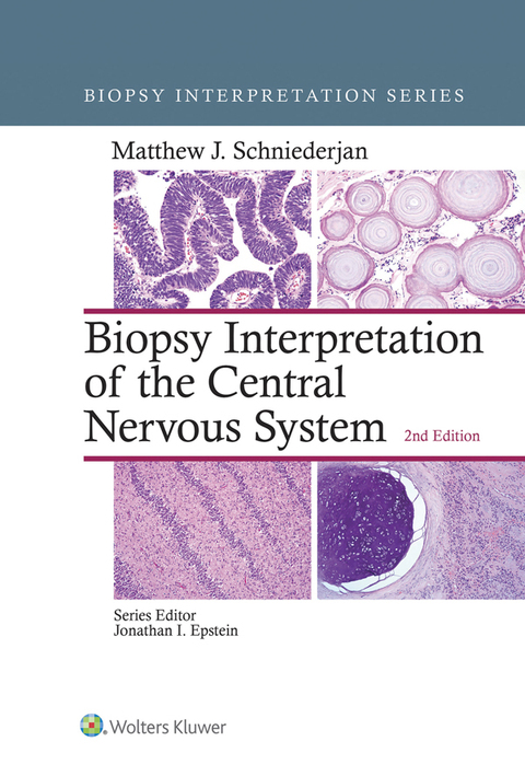 Cover image for book Biopsy Interpretation of the Central Nervous System