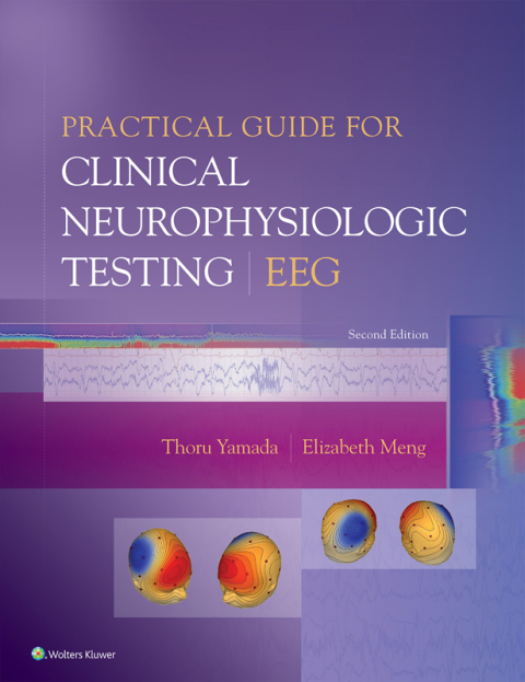 Cover image for book Practical Guide for Clinical Neurophysiologic Testing: EEG