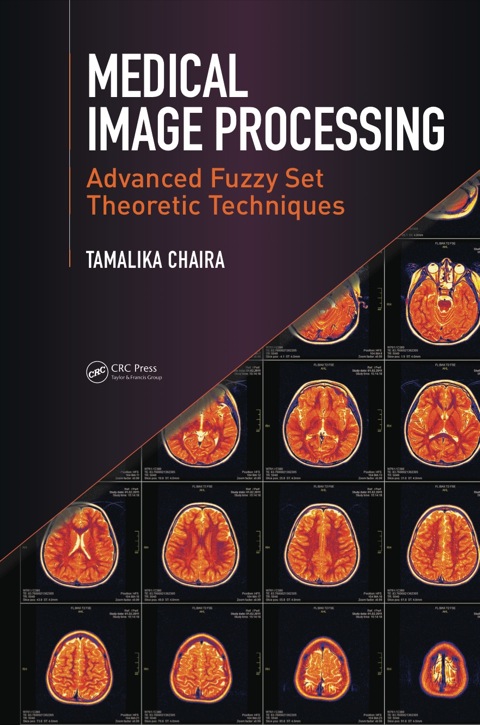 Cover image for book Medical Image Processing