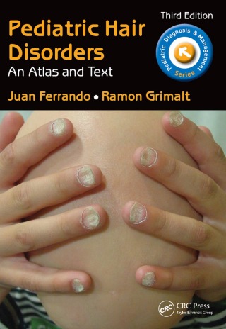 Pediatric Hair Disorders