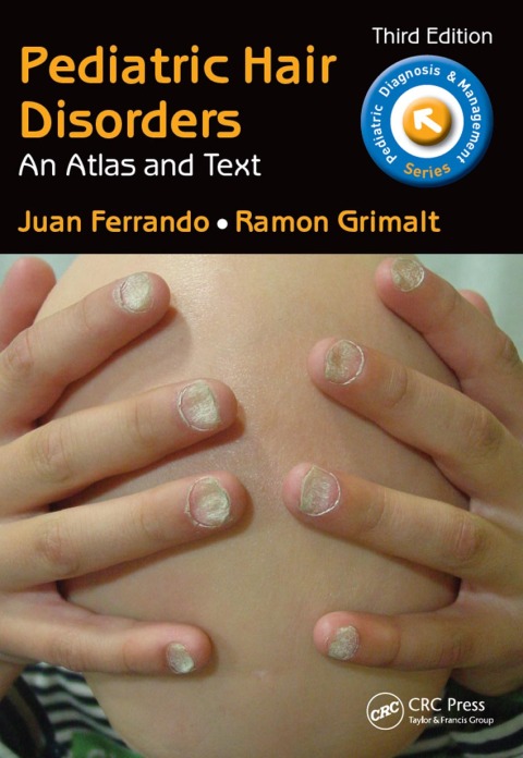 Cover image for book Pediatric Hair Disorders