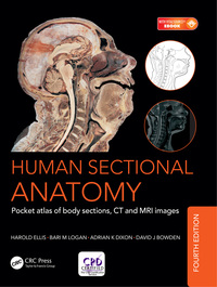 Cover image: Human Sectional Anatomy 4th edition 9781498708548