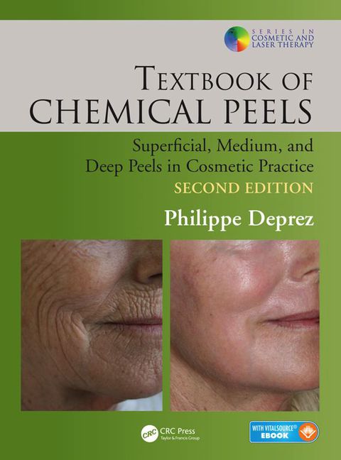 Cover image for book Textbook of Chemical Peels