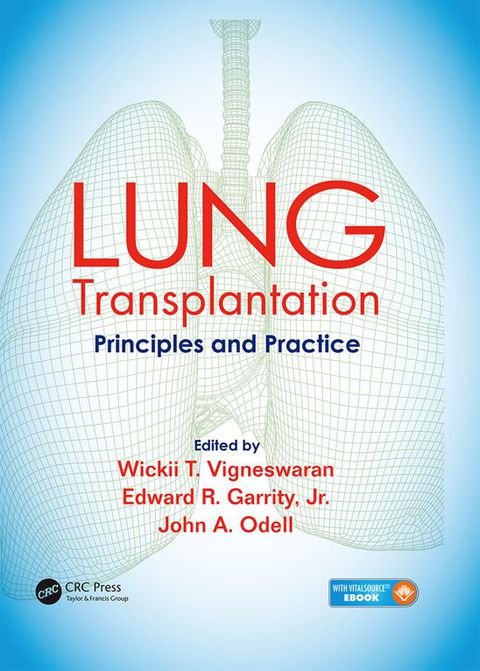 Cover image for book Lung Transplantation