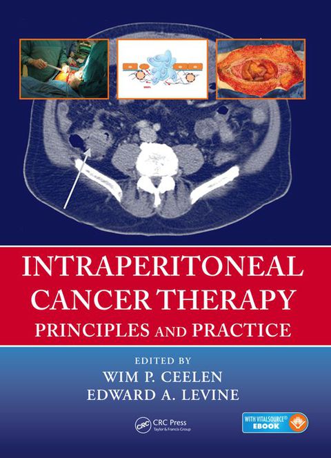 Cover image for book Intraperitoneal Cancer Therapy