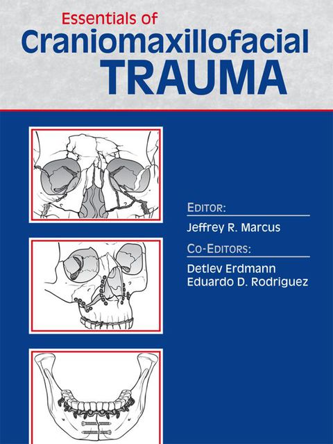 Cover image for book Essentials of Craniomaxillofacial Trauma