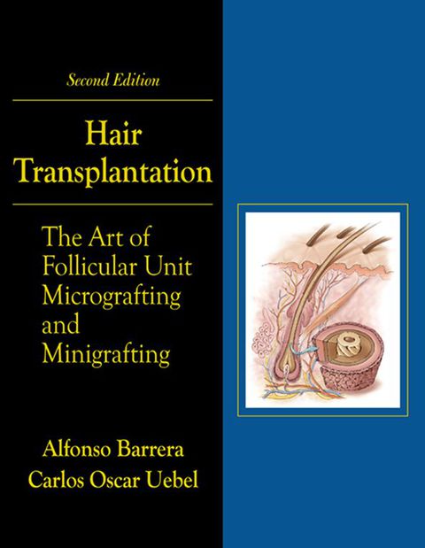 Cover image for book Hair Transplantation