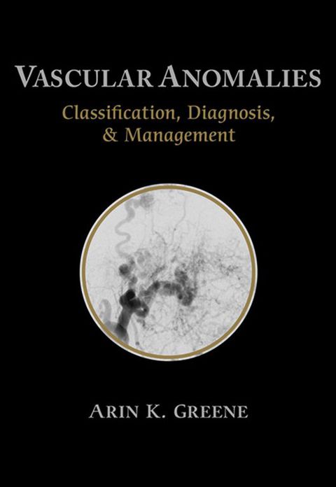 Cover image for book Vascular Anomalies