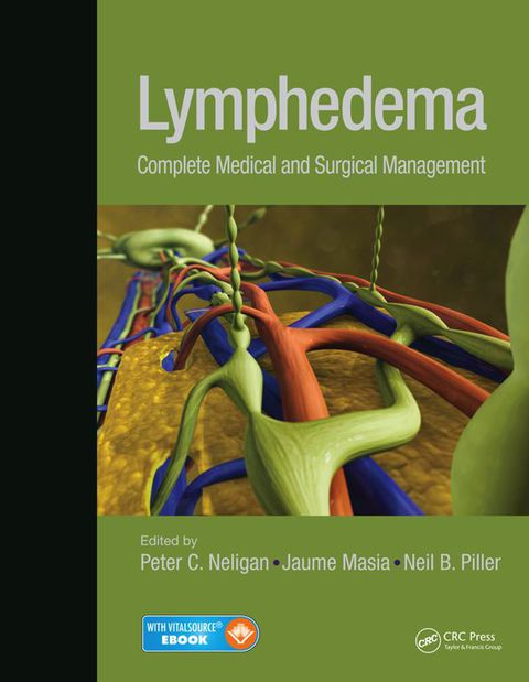 Cover image for book Lymphedema