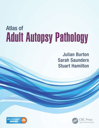Atlas of Adult Autopsy Pathology