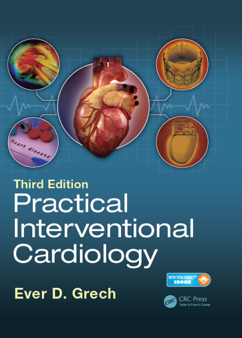 Cover image for book Practical Interventional Cardiology