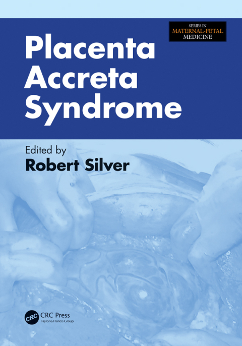 Cover image for book Placenta Accreta Syndrome