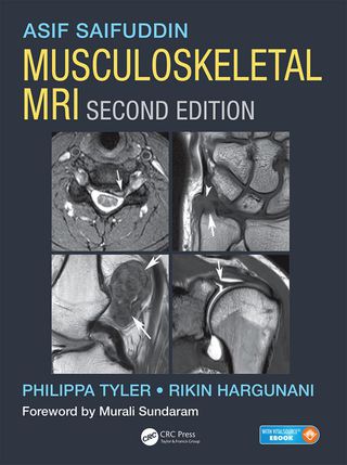 Musculoskeletal MRI