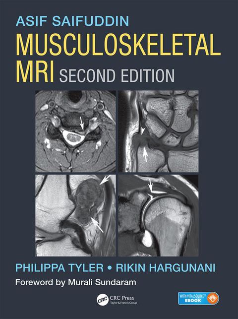 Cover image for book Musculoskeletal MRI