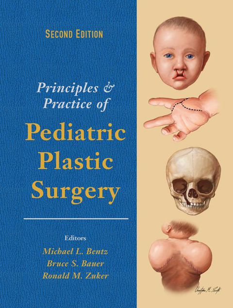 Cover image for book Principles and Practice of Pediatric Plastic Surgery - Two Volume Set
