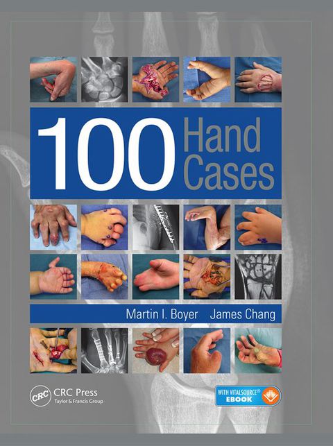 Cover image for book 100 Hand Cases