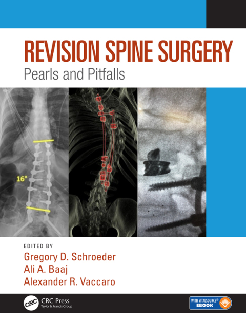 Revision Spine Surgery 