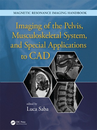 Imaging of the Pelvis, Musculoskeletal System, and Special Applications to CAD
