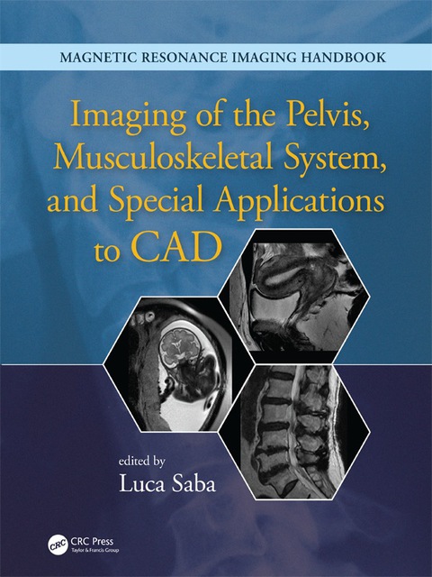 Cover image for book Imaging of the Pelvis, Musculoskeletal System, and Special Applications to CAD
