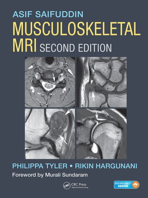 Cover image for book Musculoskeletal MRI