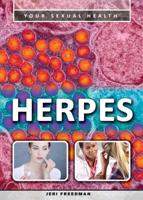 Cover image for book Herpes