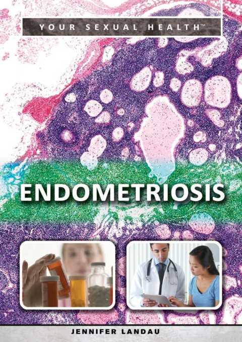 Cover image for book Endometriosis
