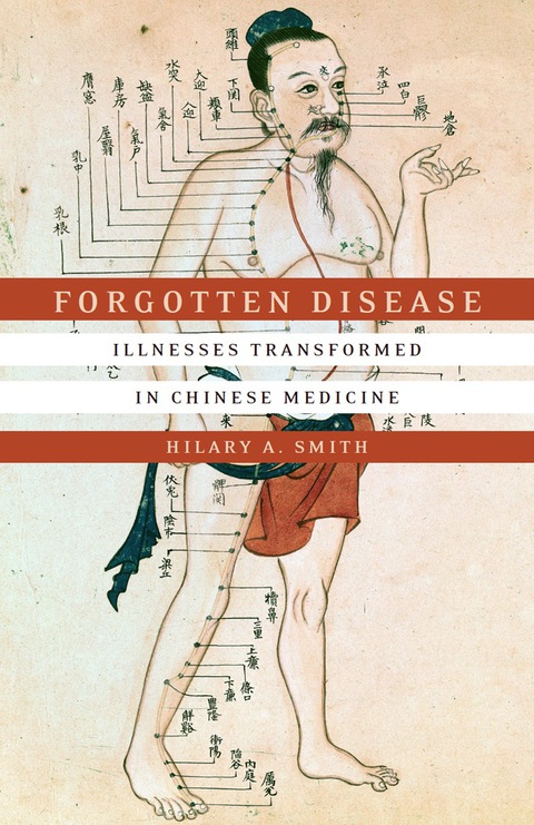 Cover image for book Forgotten Disease